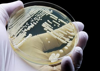 Candida Auris